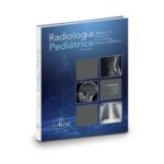 Radiología Pediátrica